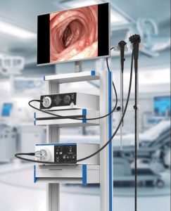 کولونوسکوپ